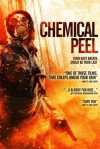 chemical peel.jpg